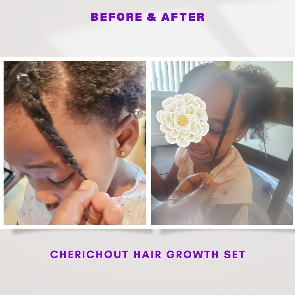 Hair growth set (Upgraded)