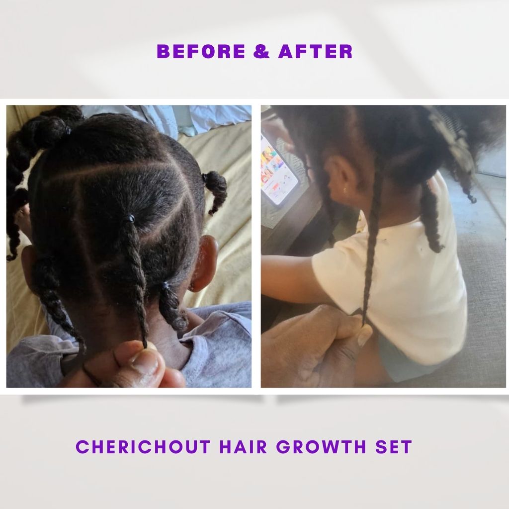 Hair growth set (Upgraded)