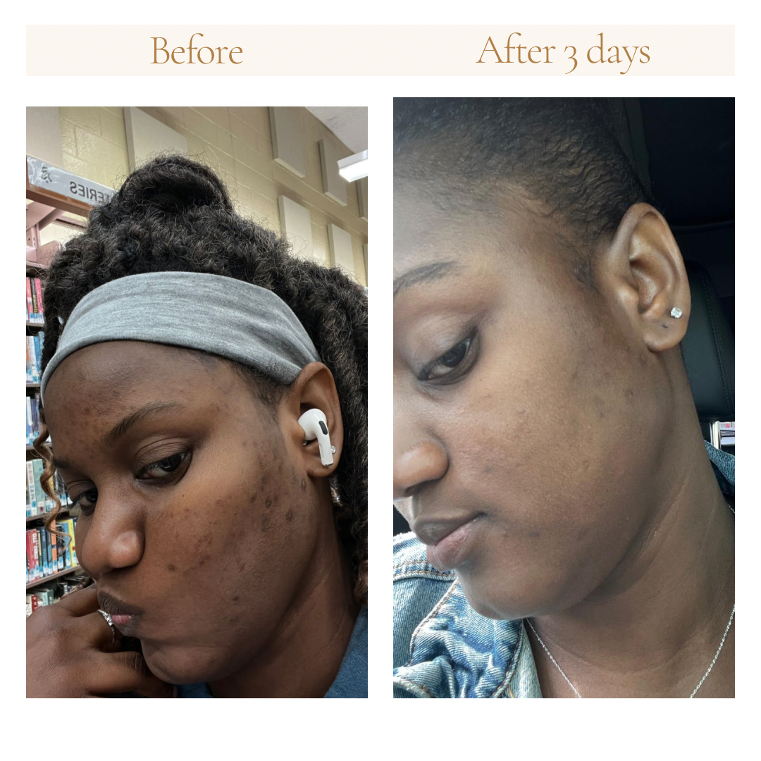 Turmeric Even Skin + Face & body oil