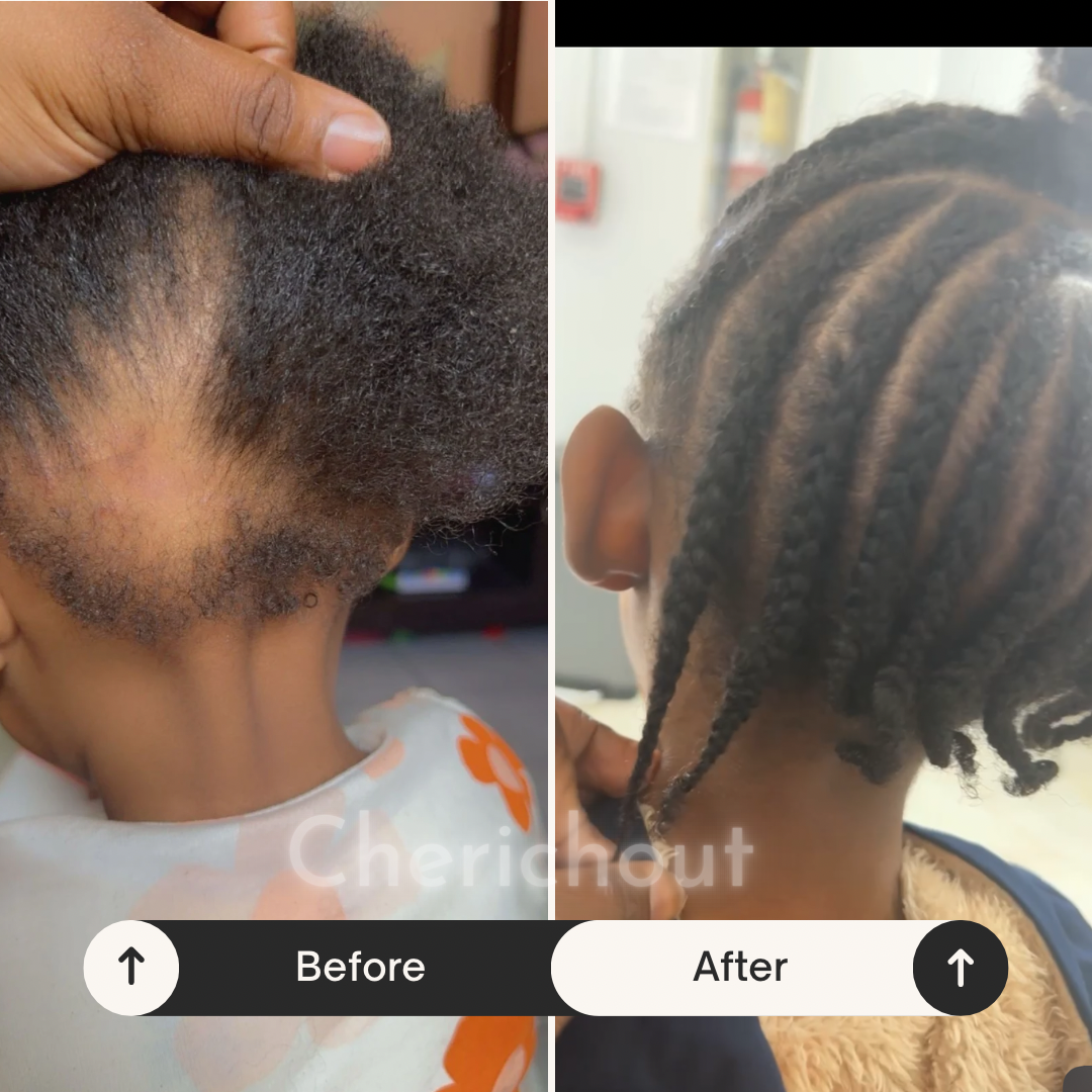 Hair growth set