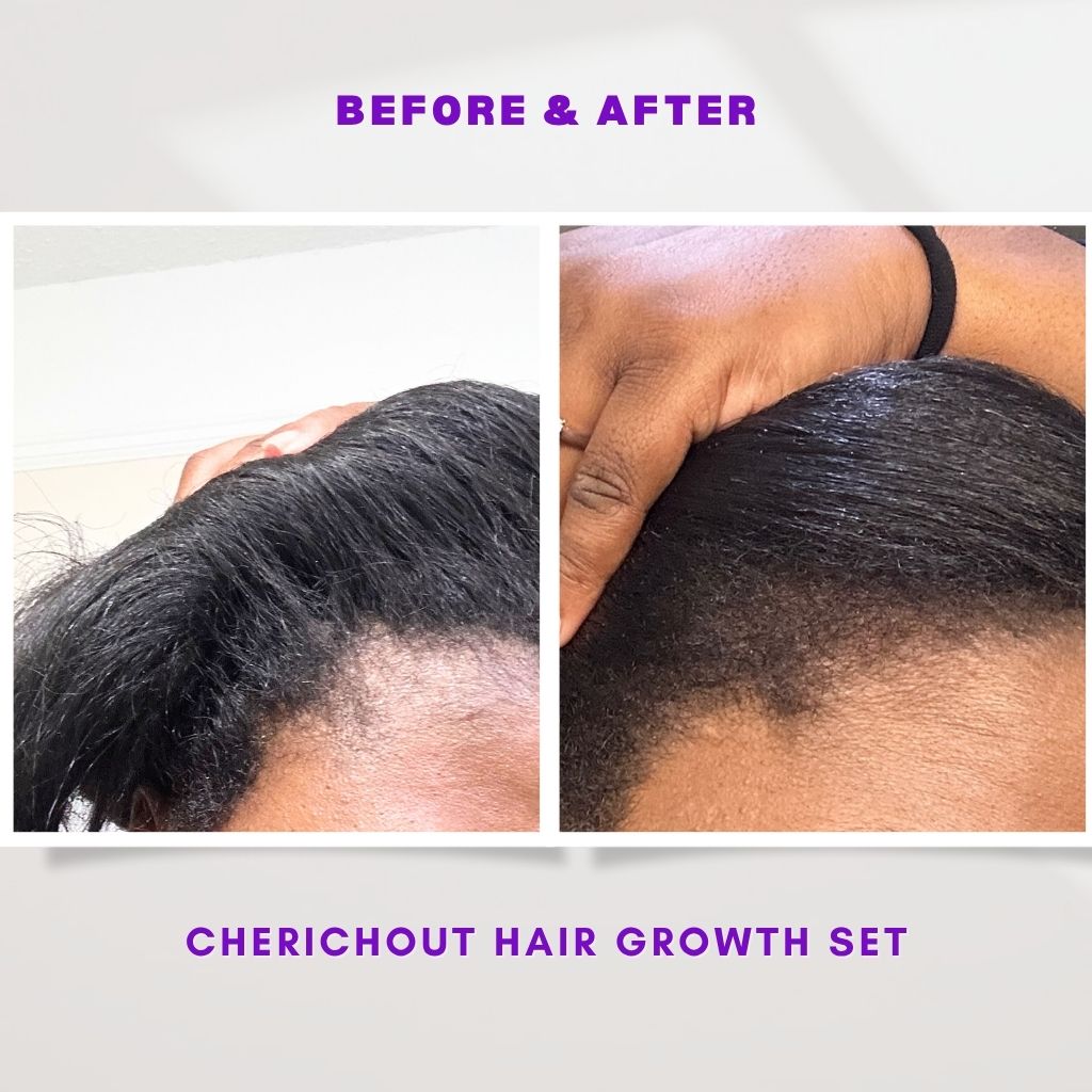 Hair growth set + gift