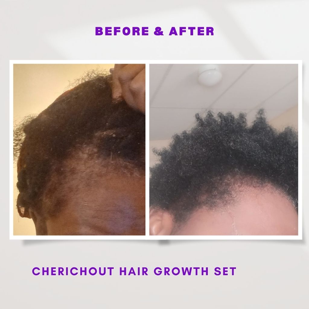 Hair growth set + gift