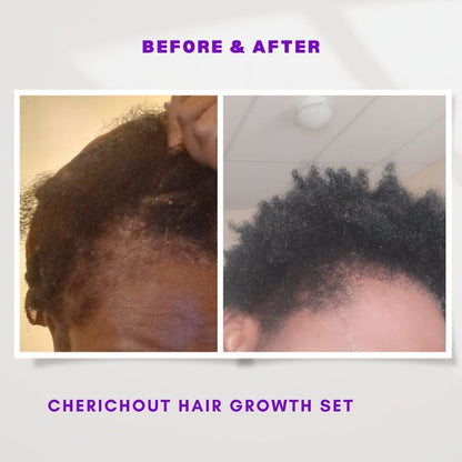 Hair growth set + gift
